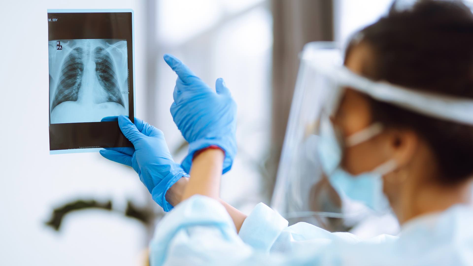 Europe sees 10 percent rise in childhood tuberculosis cases